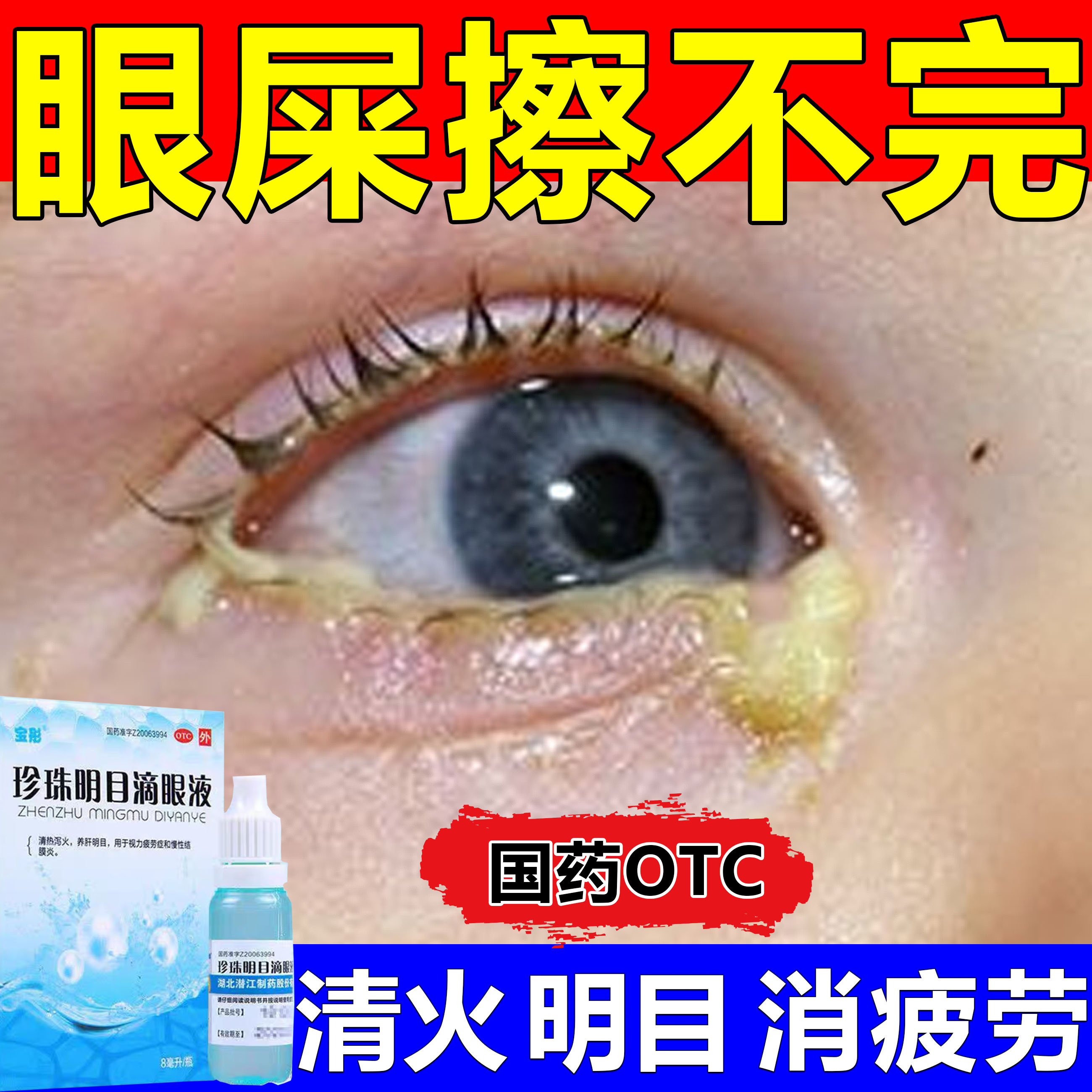 眼药水止痒消炎眼睛干涩眼屎多清热泻火结膜炎珍珠明目滴眼液