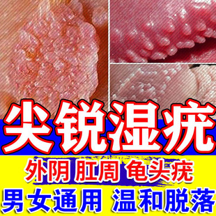尖锐湿疣男女性抗病毒专用的生殖带状疱疹感染私处药阿昔洛韦乳膏