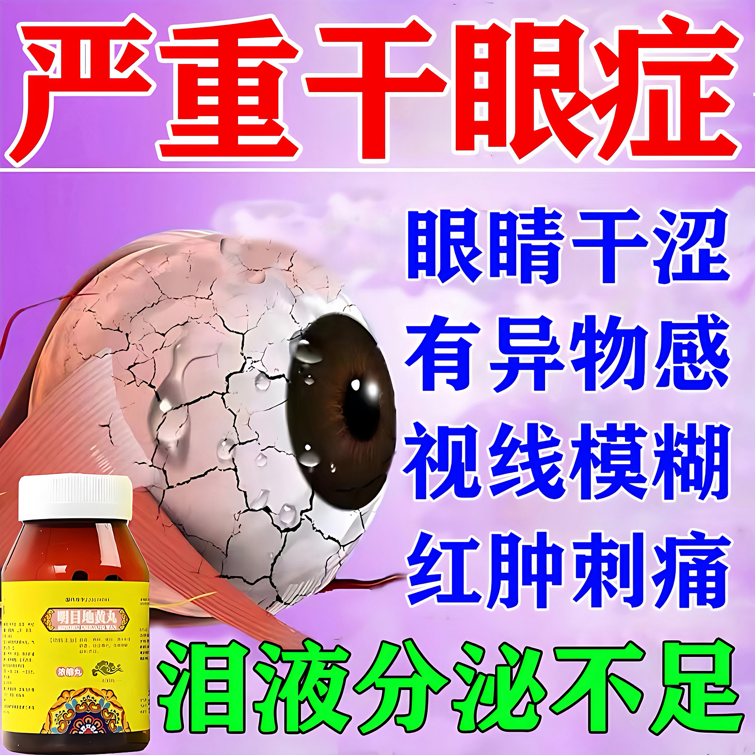 治疗干眼症的药用于眼干眼涩酸胀发痒疲劳眼睛红肿刺痛名目地黄丸