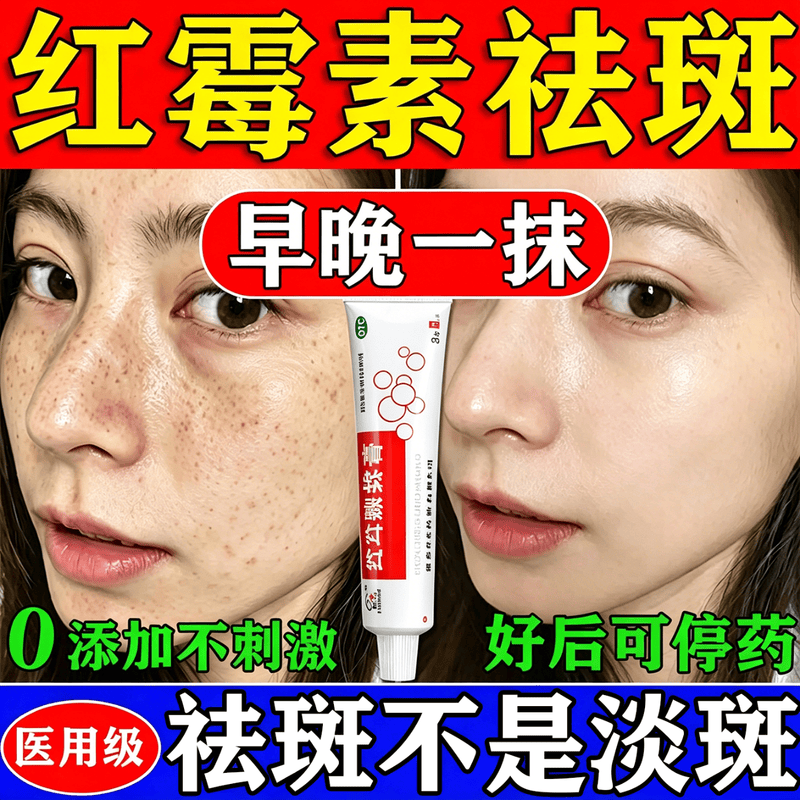 红霉素软膏祛斑眼官方旗舰店正品外医用级药去消眼袋儿童抗菌消炎