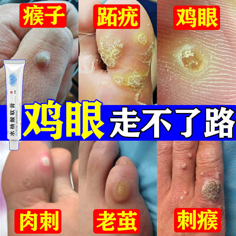 【信龙】水杨酸软膏5%*20g*1支/盒