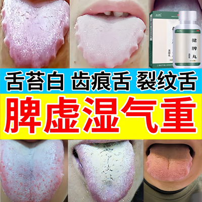 健脾丸齿痕舌裂纹舌中成药治疗脾胃虚弱引起舌苔发白头发油湿气重