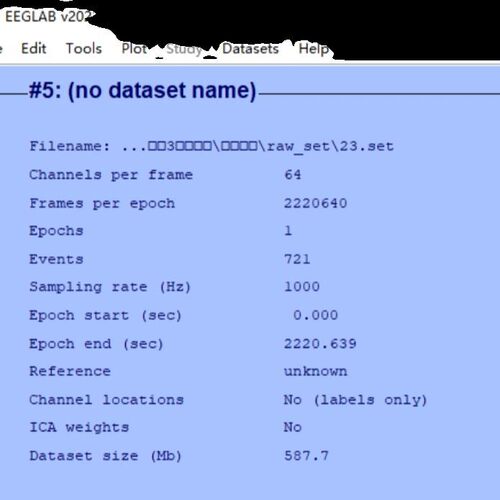 EEGLAB 脑电数据分析 ERP数据分析 EEG数据分析 脑电预处理 ICA