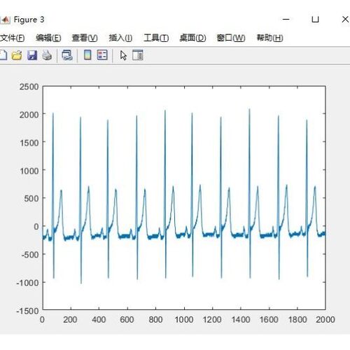 matlab python 信号分析分解  时频分析 优化阈值 小波滤波