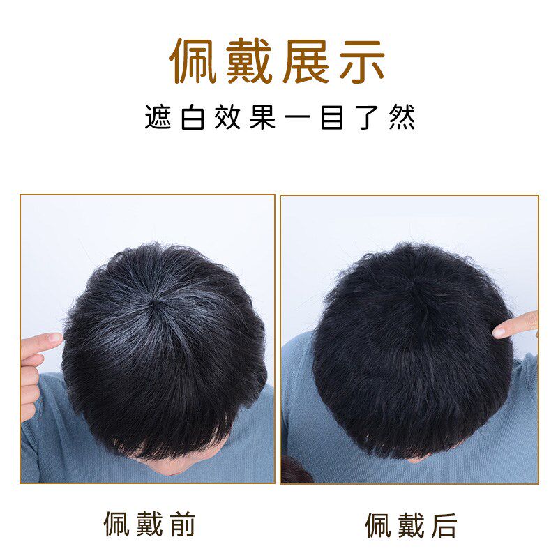 假发玉米须头顶补发片真人发丝纹理蓬松女士短发妈妈中老年补发片