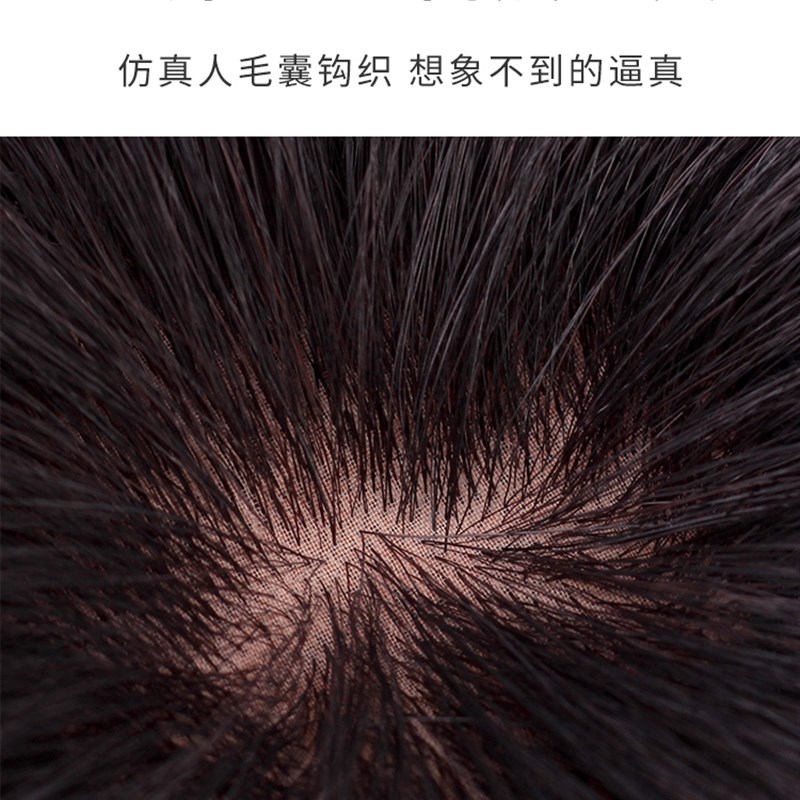 头顶头发短发遮白发假发片真发头顶补发片女一片式轻薄无痕补发块