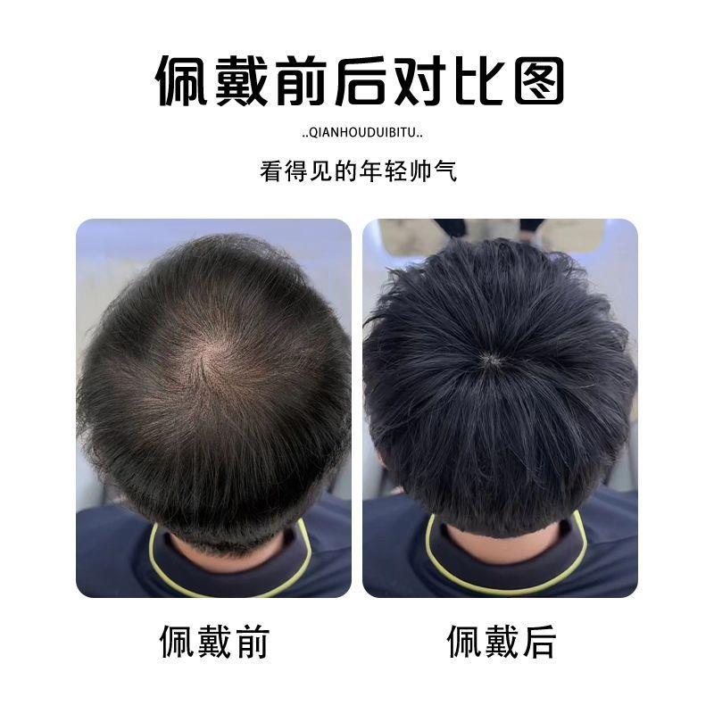 假发片男全真发遮盖白发头旋伤疤补发片递针旋遮斑秃脱发男士假发