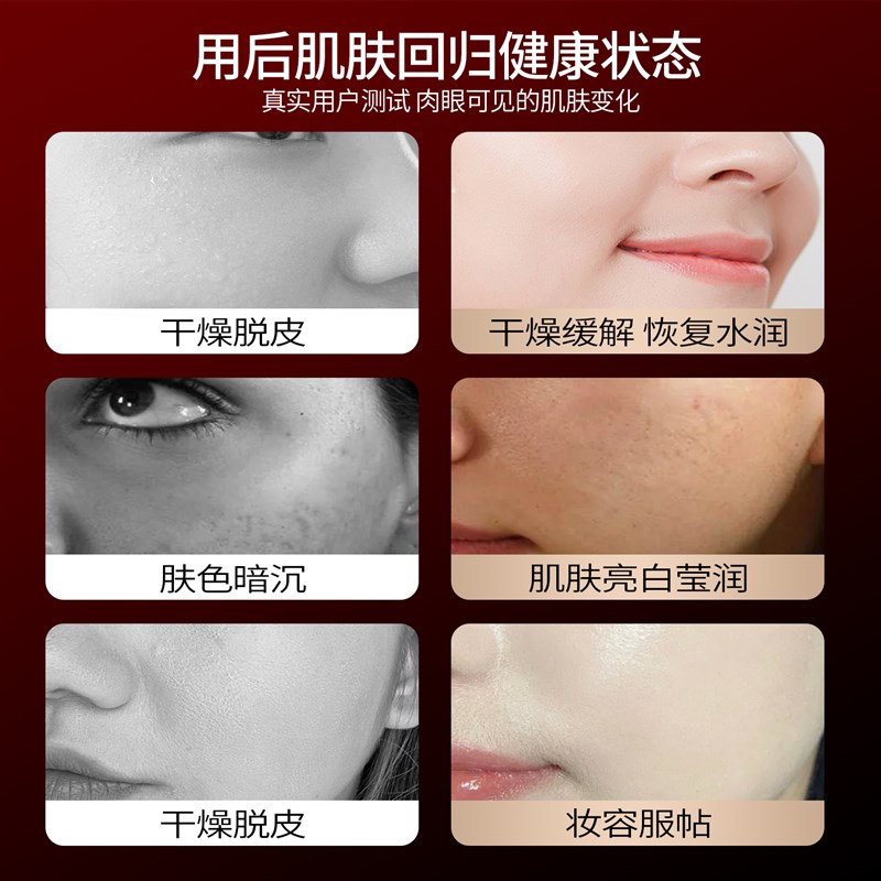 美容院专用面部补水保湿水光自打仪器注氧仪喷雾补水仪脸部美容仪