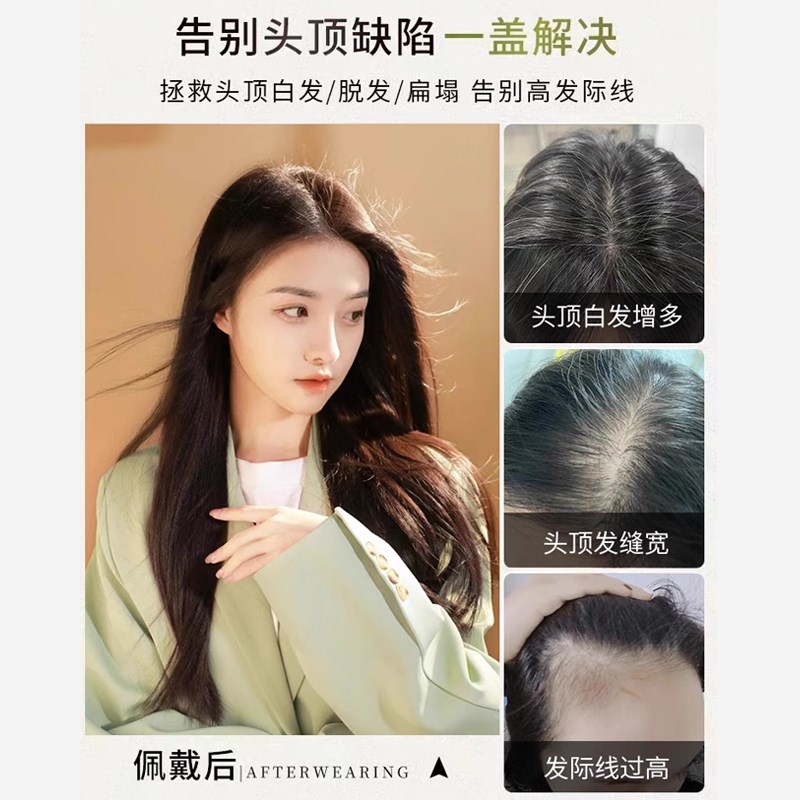 真发假发片女长发遮白发头顶补发片头顶稀少真人发丝隐形补发贴片