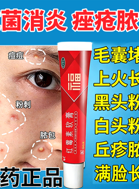 红霉素软膏消炎杀菌皮肤感染真菌痤疮化脓抗菌脓包痘痘私处外用药