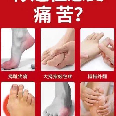 大脚骨脚趾重叠专用贴【不直全赔】拇外翻神器拇指外翻矫正专用YX