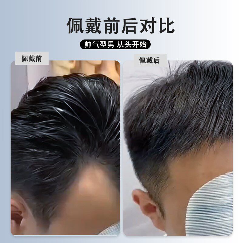 鬓角补发贴隐形无痕假发片全真人发m型前额补发片刘海片男女同用