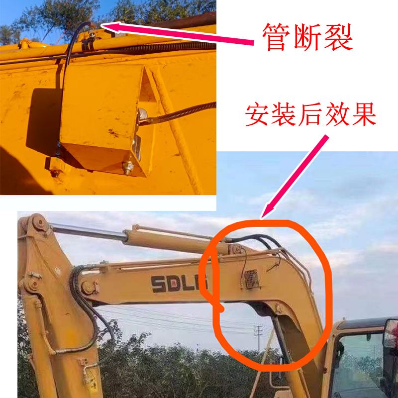 山东临工挖机黄油接头55F 60F 65F 75F 80F 85F 90F大中臂黄油管