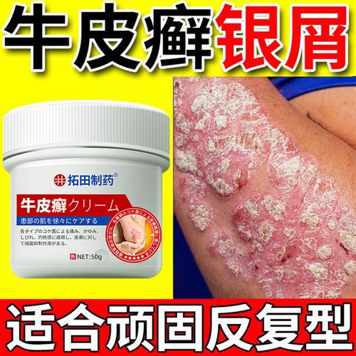 【日本进口】无激素不满可退