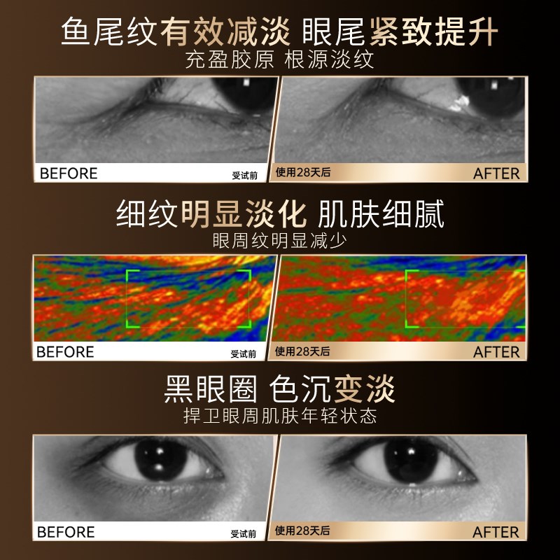 眼部按摩仪美眼仪消肿黑眼圈眼袋提拉紧致缓解疲劳按摩眼部美容仪