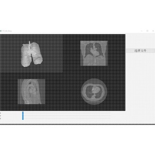 CT分割 支持JPG 可視化 PyQt 醫(yī)學圖像 PNG CT三維重建 TIF 濾波