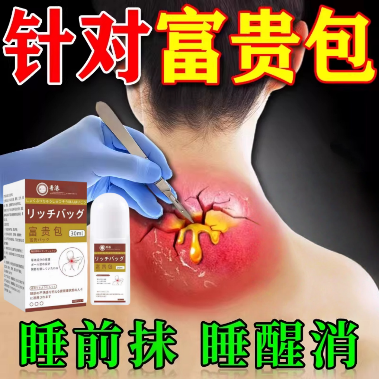 香港大药房科研富贵包膏官方旗舰店正品脖子前倾颈部鼓包疼痛