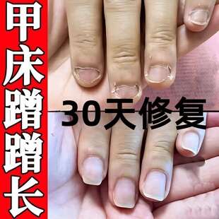 护甲油养指甲床修复生长液啃咬指甲受损萎缩再生甲肉分离空甲断裂