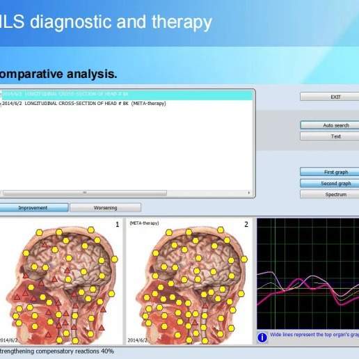 9D NLS bioplasm CELL Diagnostics Diagnostics Sub Body Health
