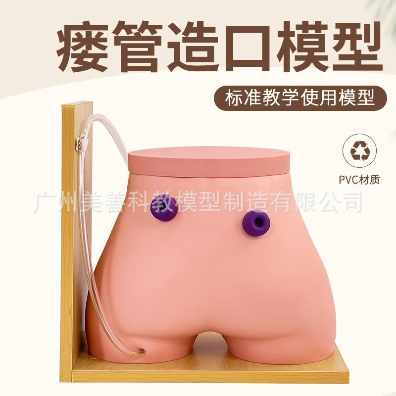 瘘管造口术护理模型造瘘练习模型结肠造口回肠造瘘模型
