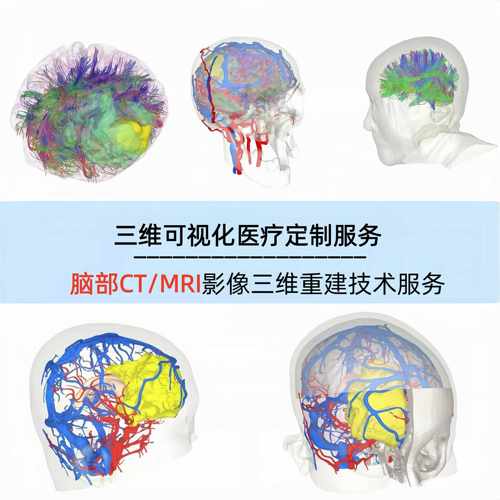 脑部CT医学影像三维重建DICOM影像文件脑神经三维可视化3D建模