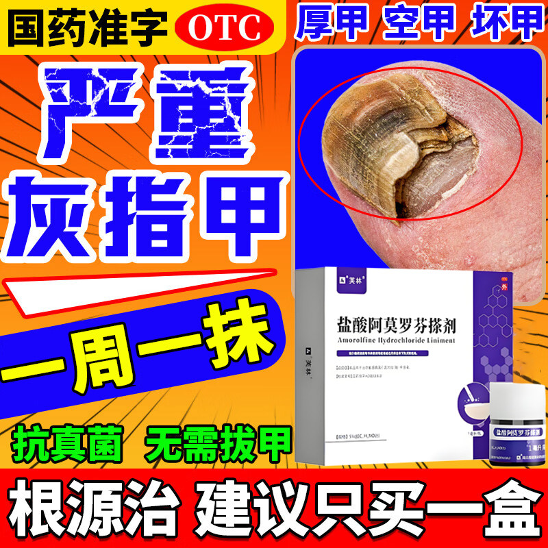 【芙林】盐酸阿莫罗芬搽剂5%*1ml*1瓶/盒