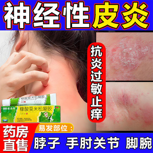 神经性皮炎外用止痒药膏湿疹皮肤干燥起皮瘙痒999皮炎平软膏正品
