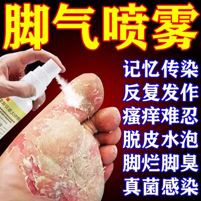 【伊人】盐酸特比萘芬喷雾剂1%*15ml*1瓶/盒