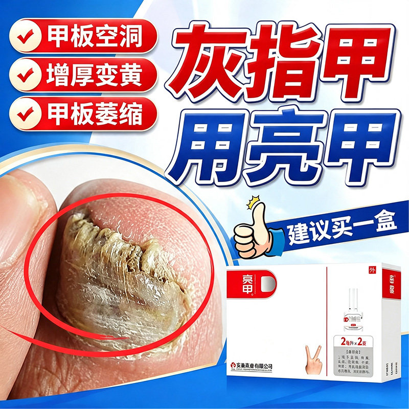 亮甲灰指甲专用正品真菌感染官方旗舰店甲板空洞增厚变黄甲板萎缩