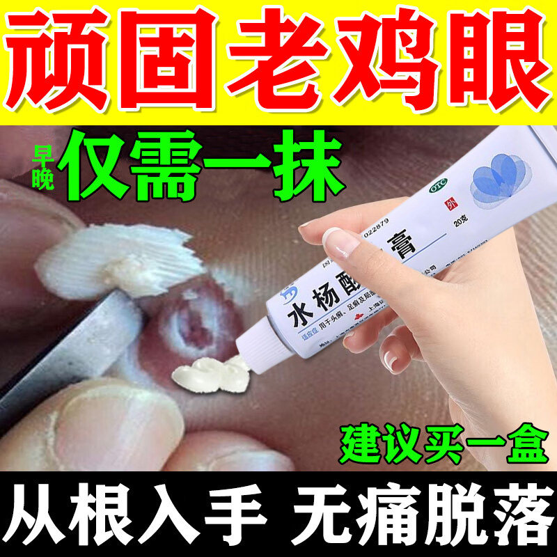 水杨酸软膏正品鸡眼药膏治疗脚底鸡眼老茧疙瘩拓疣无痛脱落专用药