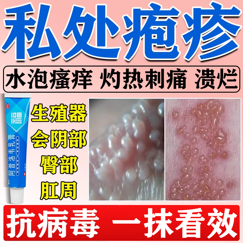 【福元】阿昔洛韦乳膏3%*10g*1支/盒