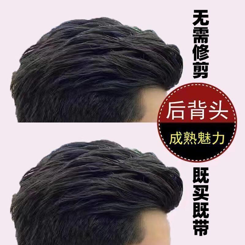 【8488人收藏】假发男短发背头男士补发块头顶补发自然无痕隐形假