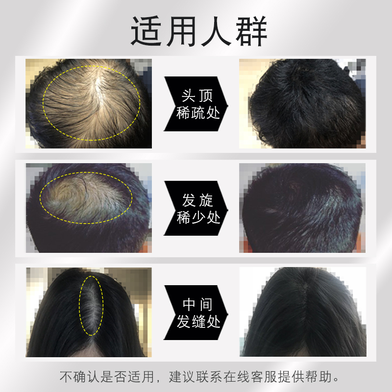头发纤维粉密发增发喷雾补发神器套装发际线喷头顶稀少秃黑色填充