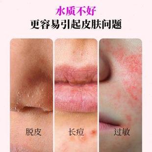 沐浴软水过滤器前置除氯润肤补水香氛淋浴台盆洗漱洗澡家用净水器