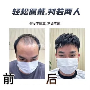 假发男npu边全递n针真发隐形无痕补发片蓬松自然头顶遮秃顶短直发