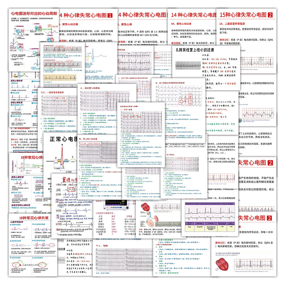 153张心电图口诀贴纸医学护理