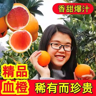 现货血橙新鲜水果红心橙子应季中华红橙秭归红肉橙脐整箱包邮现摘