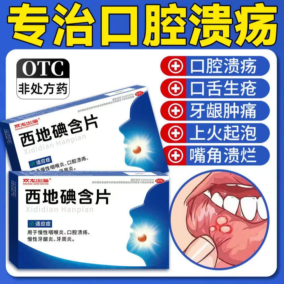 慢性咽喉炎咽痛 口腔溃疡反复 牙龈炎 双龙出海西地碘含片14片