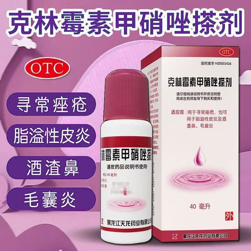 寻常痤疮治疗 溢脂性皮炎酒糟鼻 天龙克林霉素甲硝唑搽剂40ml