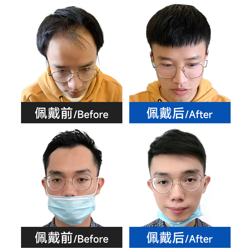 男士前额假发片发际线假发贴刘海m型假发男短发真人发丝假发贴片