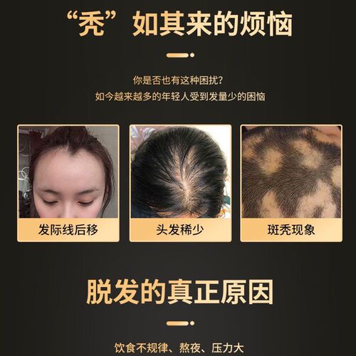 toppik头发纤维发际线增发密发遮发神器增发纤维粉头顶补发假发粉