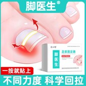 JIAOYISHENG 脚医生脚趾甲贴片嵌甲甲沟炎矫正指甲专用正甲贴足部