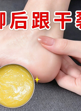 手足脚后跟干裂足霜手脱皮起皮滋润补水护手霜开裂干燥硬皮脚跟