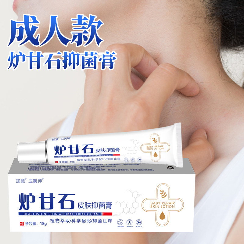 卫芙神炉甘石全身手脚干痒真菌感染皮肤瘙痒无激素皮肤外用软膏