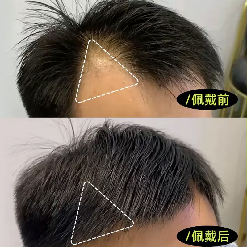 男士假刘海片鬓角补发假发片男女全真人发m型前额发际线假发贴片