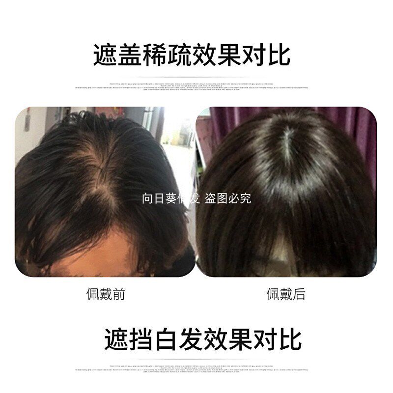 高颅顶女头顶补发片真发增发量遮白发隐形无痕蓬松自然刘海假发片
