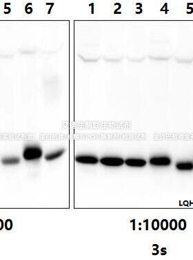Bioworld甘油醛-3-磷酸脱氢酶GAPDH(1A6)单克隆抗体/-HRP内参抗体
