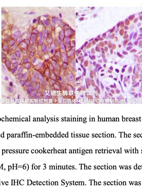 Bioworld超敏免疫组化检测试剂盒(鼠/兔) IHC辅助试剂 DAPI试剂盒