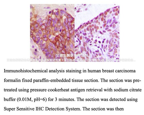 Bioworld超敏免疫组化检测试剂盒(鼠/兔) IHC辅助试剂 DAPI试剂盒
