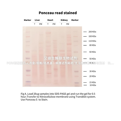 Invent®Na⁺/K⁺ATPase α1重组兔单克隆抗体 细胞膜/质膜标记物